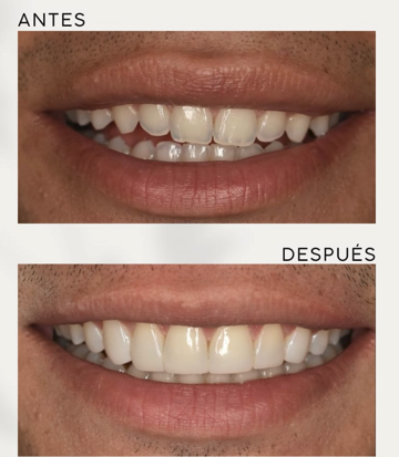 Odontología Estetica